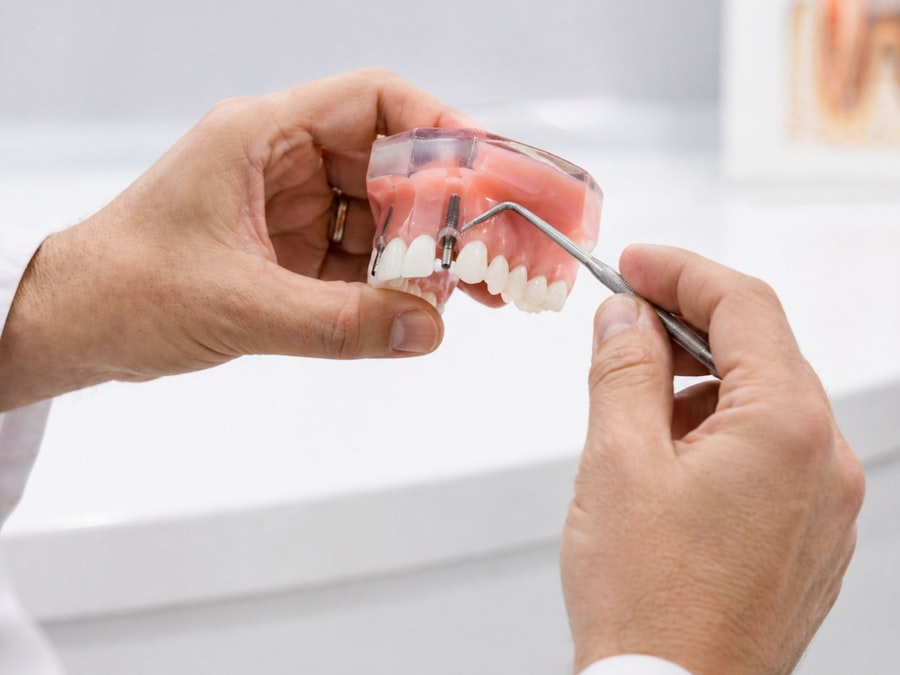 Modelo odontológico com implante dentário
